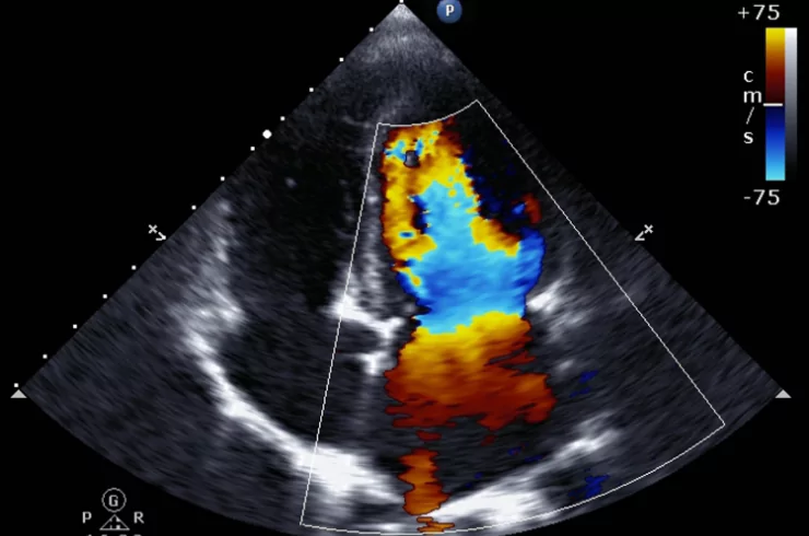 sahardiagnosticcentre-colour-doppler-66f16da69232e